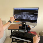 UCLA Surgeon Pioneers First 3D Printed Model in Orthopedic Operation